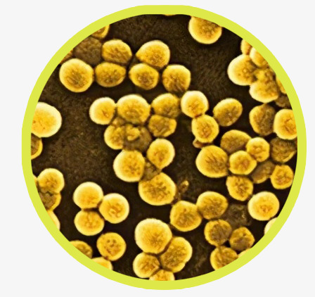 金黄色葡萄球菌